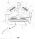 Fig. 02 - Implantable medical devices