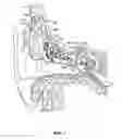 Fig. 02 - Apparatus for connection of implantable devices to the auditory system