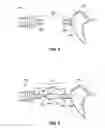 Fig. 04 - Apparatus for connection of implantable devices to the auditory system