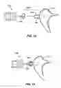 Fig. 08 - Apparatus for connection of implantable devices to the auditory system