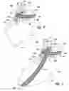 Fig. 06 - Methods and implantable apparatuses for treating an esophageal disorder such as gastroesophageal reflux disease