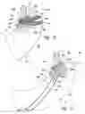 Fig. 07 - Methods and implantable apparatuses for treating an esophageal disorder such as gastroesophageal reflux disease