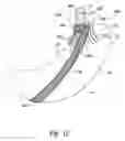 Fig. 08 - Methods and implantable apparatuses for treating an esophageal disorder such as gastroesophageal reflux disease