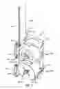Fig. 07 - Guide systems for laminated spring assemblies