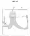 Fig. 11 - Endoscope device