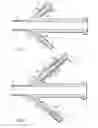 Fig. 04 - OVERTUBE FOR ENDOSCOPE AND ENDOSCOPE SYSTEM