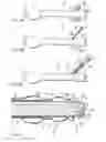 Fig. 05 - OVERTUBE FOR ENDOSCOPE AND ENDOSCOPE SYSTEM