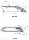 Fig. 04 - Precision sensing and treatment delivery device for promoting healing in living tissue