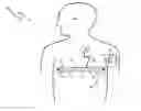 Fig. 01 - CHEST STRAP FOR MEASURING VITAL SIGNS