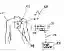 Fig. 01 - System and method for analyzing cardiovascular pressure measurements made within a human body