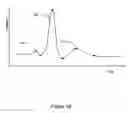Fig. 03 - Discriminating polymorphic and monomorphic cardiac rhythms using template generation