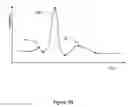 Fig. 03 - Arrhythmia discrimination based on determination of rate dependency