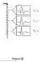 Fig. 05 - Arrhythmia discrimination based on determination of rate dependency