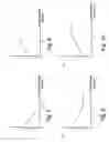 Fig. 08 - Macro-control of treatment for sleep disordered breathing