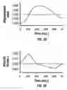Fig. 04 - Method and apparatus for penetrating tissue