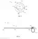 Fig. 03 - Method and apparatus for uterine cavity length measurement
