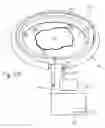 Fig. 09 - Wound shield and warming apparatus and method
