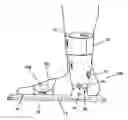 Fig. 01 - Orthopedic night foot splint