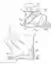Fig. 02 - System and method for correcting clubfoot problems in children