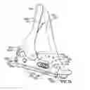 Fig. 16 - System and method for correcting clubfoot problems in children