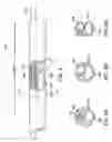 Fig. 05 - Catheter for guidewire placement