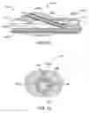 Fig. 07 - Catheter for guidewire placement