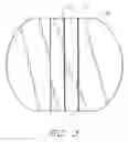 Fig. 03 - ANCHORING SYSTEM FOR A MEDICAL ARTICLE