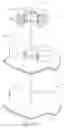 Fig. 15 - ANCHORING SYSTEM FOR A MEDICAL ARTICLE
