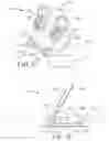 Fig. 13 - Intravenous catheter anchoring device