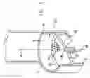 Fig. 02 - Membrane support for drip chamber