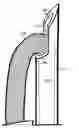 Fig. 01 - U-shaped disc shunt and delivery device