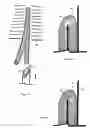 Fig. 03 - U-shaped disc shunt and delivery device