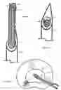 Fig. 17 - U-shaped disc shunt and delivery device