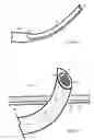 Fig. 18 - U-shaped disc shunt and delivery device