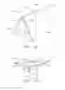 Fig. 10 - Absorbent article and system comprising thong-shaped holder