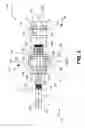 Fig. 05 - Method and apparatus for controlled vessel occlusion