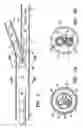 Fig. 04 - Bifurcated catheter for agent delivery and method of agent delivery