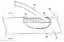 Fig. 01 - Medical catheters of modular construction