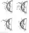 Fig. 04 - METHOD AND SYSTEM FOR ALTERING THE REFRACTIVE PROPERTIES OF THE EYE