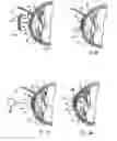 Fig. 06 - METHOD AND SYSTEM FOR ALTERING THE REFRACTIVE PROPERTIES OF THE EYE