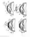 Fig. 08 - METHOD AND SYSTEM FOR ALTERING THE REFRACTIVE PROPERTIES OF THE EYE
