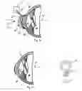 Fig. 11 - METHOD AND SYSTEM FOR ALTERING THE REFRACTIVE PROPERTIES OF THE EYE