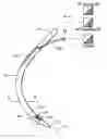 Fig. 01 - Surgical instruments and techniques for treating gastro-esophageal reflux disease