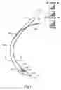 Fig. 02 - Surgical instruments and techniques for treating gastro-esophageal reflux disease