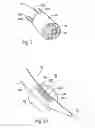Fig. 03 - Surgical instruments and techniques for treating gastro-esophageal reflux disease