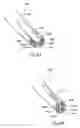 Fig. 11 - Surgical instruments and techniques for treating gastro-esophageal reflux disease