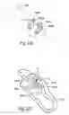 Fig. 14 - Surgical instruments and techniques for treating gastro-esophageal reflux disease