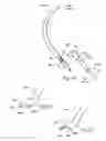 Fig. 15 - Surgical instruments and techniques for treating gastro-esophageal reflux disease