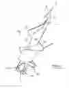 Fig. 02 - Threaded suture anchor with starting pitch