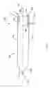 Fig. 06 - SPINAL IMPLANT INSERTION INSTRUMENT AND METHOD